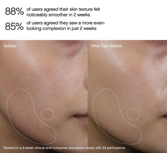 Faded Dark Spot Peel Pads